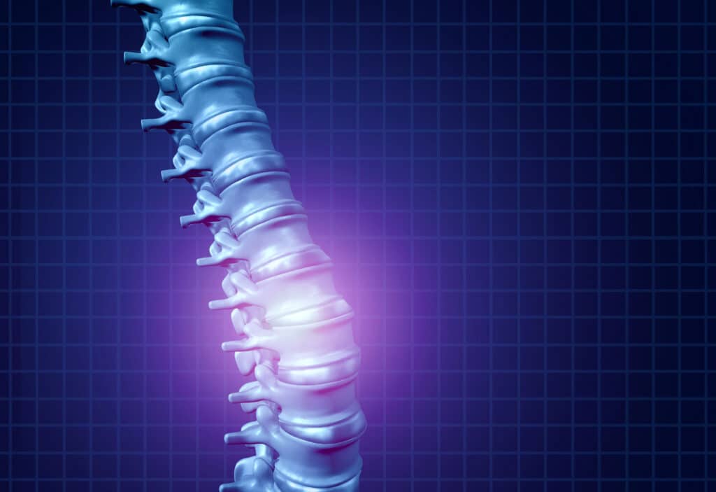 spinal