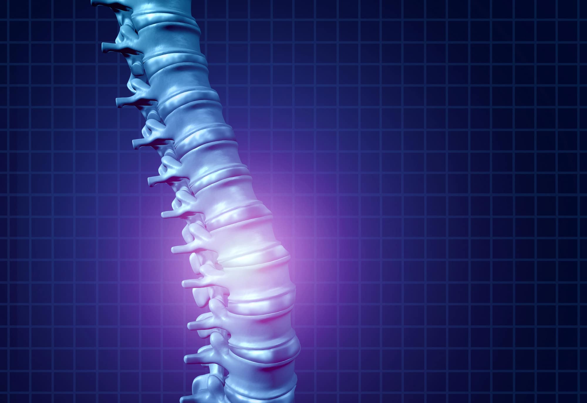 What Are The Long-Term Effects Of Spinal Cord Injuries?